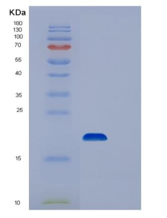 Recombinant Human UBC9 Protein,Recombinant Human UBC9 Protein