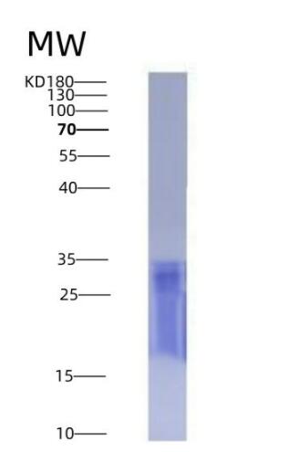 Eukaryotic Tetraspanin 30Cluster of Differentiation 63 (CD63),Eukaryotic Tetraspanin 30Cluster of Differentiation 63 (CD63)