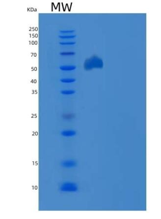 Recombinant Mouse EphB3 / HEK2 Protein (His tag),Recombinant Mouse EphB3 / HEK2 Protein (His tag)