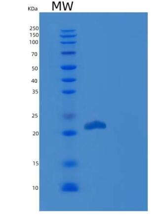 Recombinant Human GH1 / Growth hormone 1 Protein,Recombinant Human GH1 / Growth hormone 1 Protein