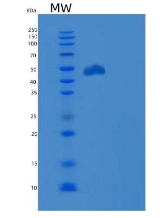 Recombinant Human PD-L1 / B7-H1 / CD274 Protein (ECD, Fc Tag),Recombinant Human PD-L1 / B7-H1 / CD274 Protein (ECD, Fc Tag)