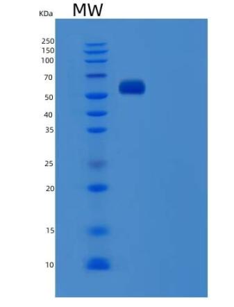 Recombinant Human Serum Albumin / HSA / ALB Protein,Recombinant Human Serum Albumin / HSA / ALB Protein