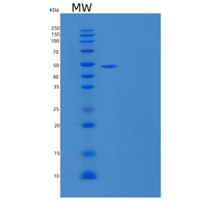 Recombinant Human Serpin A10/ZPI Protein(C-6His),Recombinant Human Serpin A10/ZPI Protein(C-6His)