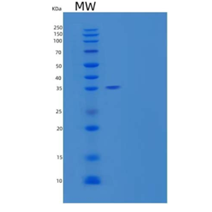 Recombinant Human Methionine Aminopeptidase 1D/MetAP1D/MAP1D Protein(N, C-6His)