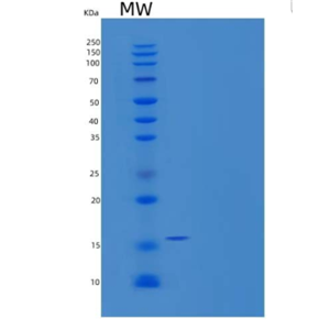 Recombinant Human Microtubule-Associated Protein Tau/MAPT-D/Tau-D Protein(C-6His)