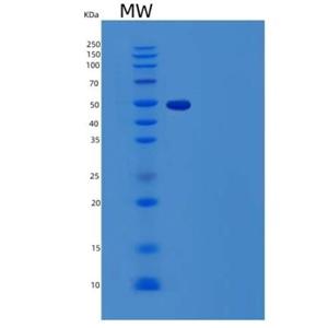 Recombinant Human Grancalcin/GCA Protein(N-GST)