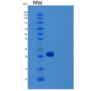 Recombinant Human VEGFC Protein,Recombinant Human VEGFC Protein