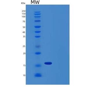 Recombinant Human Cystatin SN/CST1 Protein(C-6His),Recombinant Human Cystatin SN/CST1 Protein(C-6His)