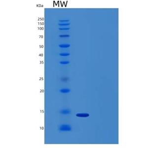 Recombinant Human Activin Receptor 2B/Activin RIIB/ACVR2B Protein(C-6His)