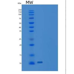Recombinant Human C-C Motif Chemokine 16/CCL16 Protein