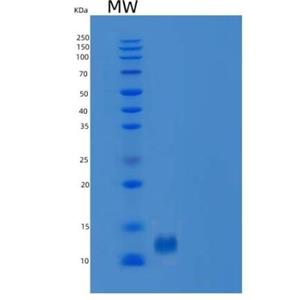 Recombinant Human B2M / Beta-2-microglobulin Protein (His tag)