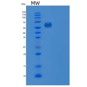 Recombinant Human EphB6 / EphB6 Protein,Recombinant Human EphB6 / EphB6 Protein