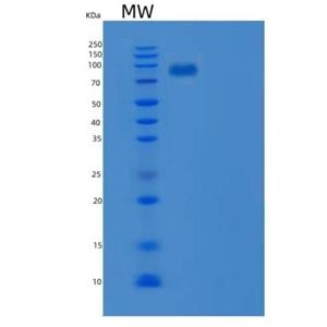 Recombinant Mouse MAG / GMA / Siglec-4 Protein (ECD, Fc Tag)