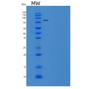 Recombinant Mouse EphB4 / HTK Protein (Fc tag)(Fc tag)