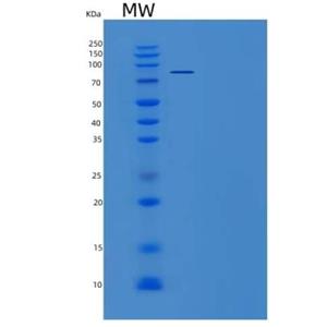 Recombinant Mouse Smad3 Protein (His & GST tag)