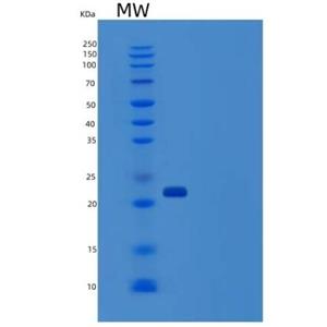 Recombinant Human CD32a / FCGR2A Protein (167 Arg, His tag)