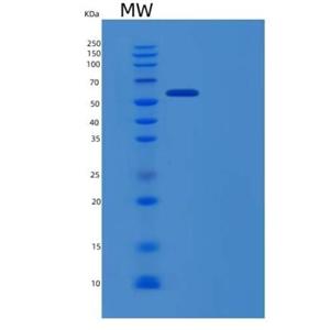 Recombinant Human EphB6 / EphB6 Protein (His tag)