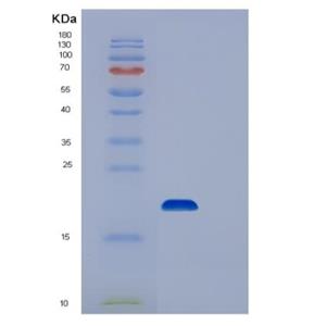 Recombinant Human UBC9 Protein,Recombinant Human UBC9 Protein