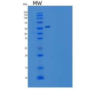 Recombinant Rat IL7R / IL7RA Protein (Fc tag)