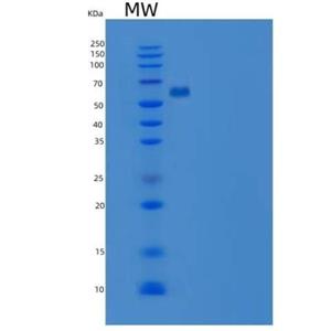 Recombinant Mouse EphA4 / HEK8 Protein (His tag)