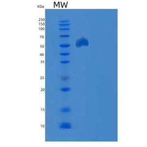 Recombinant Mouse EphB3 / HEK2 Protein (His tag),Recombinant Mouse EphB3 / HEK2 Protein (His tag)