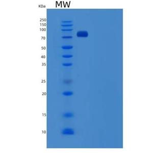 Recombinant Human SCARB1 / CD36L1 / CLA-1 Protein (His & Fc tag)