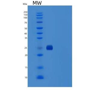 Recombinant Mouse CD122 / IL2RB / IL2 Receptor beta Protein (His tag)