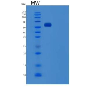Recombinant Human Serum Albumin / HSA / ALB Protein
