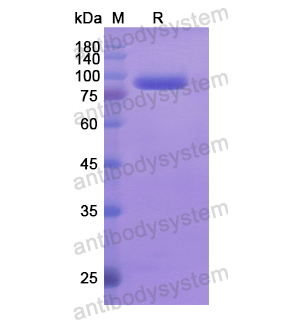 重组CD283/TLR3蛋白,Recombinant Human CD283/TLR3, N-His