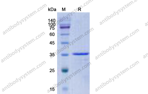 重组CCL16/HCC-4蛋白,Recombinant Human CCL16/HCC-4, N-GST