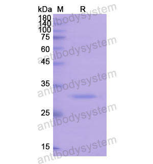 重組PDK1/PDPK1蛋白,Recombinant Human PDK1/PDPK1, N-His