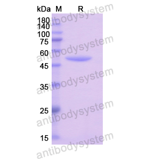 重組RS1蛋白,Recombinant Human RS1, N-GST