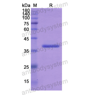 重組ADAM12蛋白,Recombinant Human ADAM12, N-His