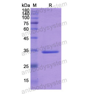 重組IRAK2蛋白,Recombinant Human IRAK2, N-His