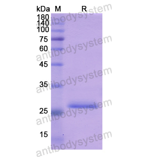 重組KLK10蛋白,Recombinant Human KLK10, N-His