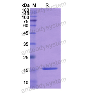 重組TGFB1I1蛋白,Recombinant Human TGFB1I1, N-His