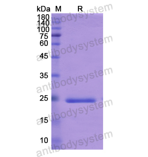 重組ADCY6蛋白,Recombinant Human ADCY6, N-His