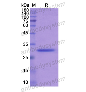 重组AQP9蛋白,Recombinant Human AQP9, N-GST