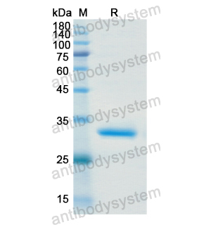 重组MAP3K7蛋白,Recombinant Human MAP3K7, N-His