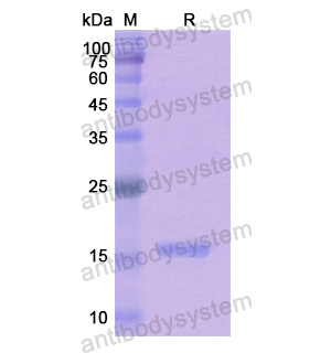 重组FIBP蛋白,Recombinant Human FIBP, N-His