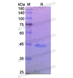重组MGAM/MGA蛋白,Recombinant Human MGAM/MGA, N-His