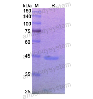 重組MGAM/MGA蛋白,Recombinant Human MGAM/MGA, N-His