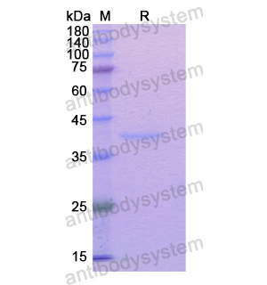 重組TGOLN2蛋白,Recombinant Human TGOLN2, N-His