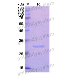 重組ADAM20 Protein蛋白,Recombinant Human ADAM20 Protein, N-His