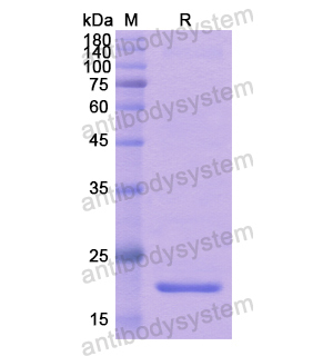 重組WIPF1蛋白,Recombinant Human WIPF1, N-His