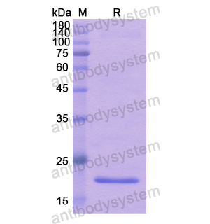 重组CD258/TNFSF14/LIGHT蛋白,Recombinant Human CD258/TNFSF14/LIGHT, N-His