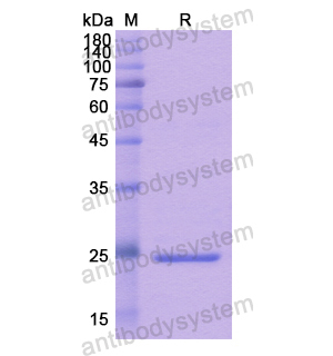 重組LAT蛋白,Recombinant Human LAT, N-His