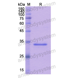 重組CA12蛋白,Recombinant Human CA12, N-His