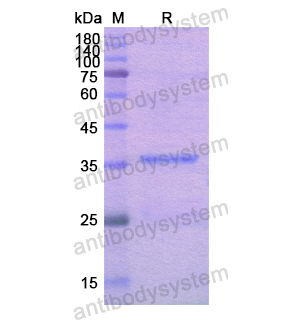 重组ACTN4蛋白,Recombinant Human ACTN4, N-His