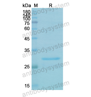 重组PRKAB2蛋白,Recombinant Human PRKAB2, N-His